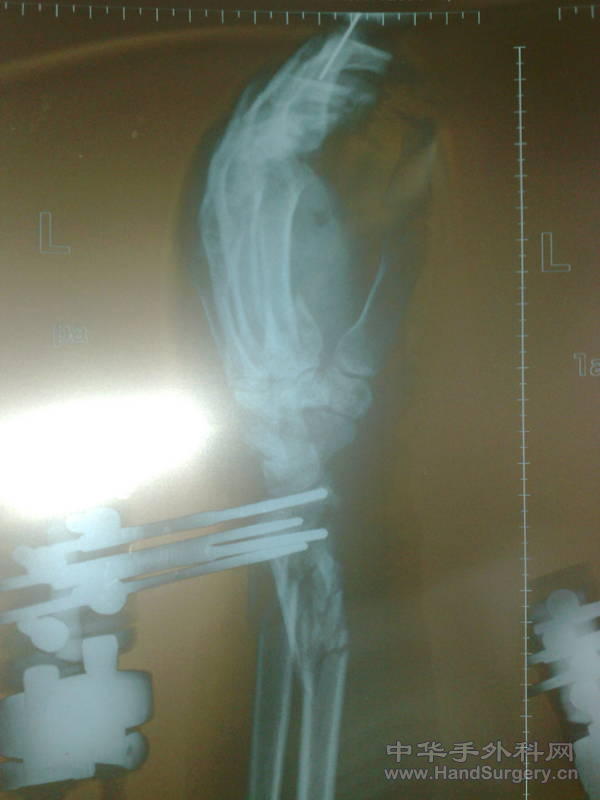 20101031154.jpg
