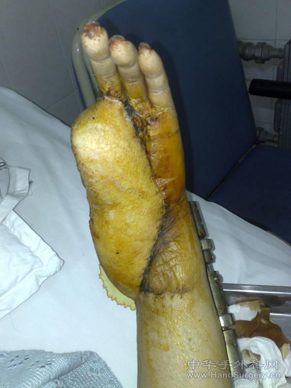 20101119162.jpg