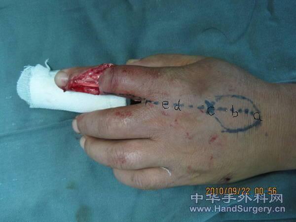 215700gnjvj4j9r4jd43uv.jpg.thumb.jpg