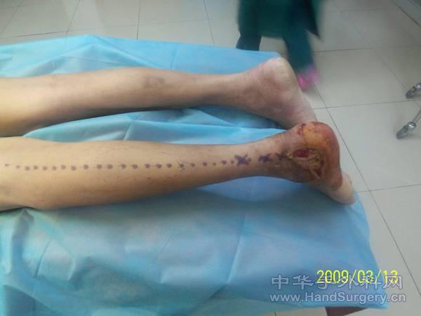 100_2922.JPG