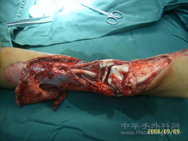 SUC53613.JPG