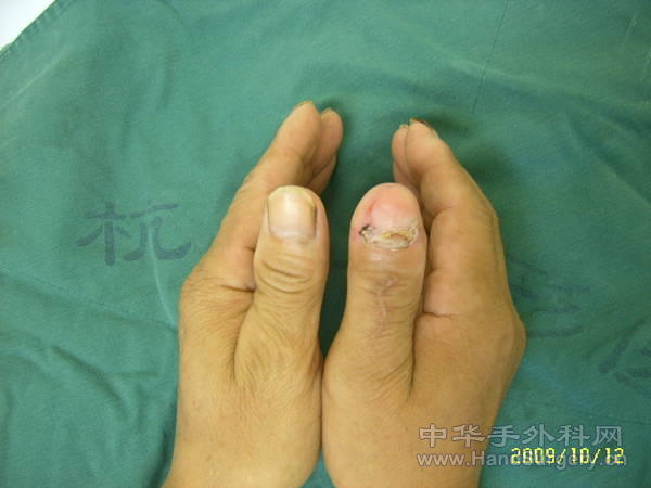 Suc55297.jpg