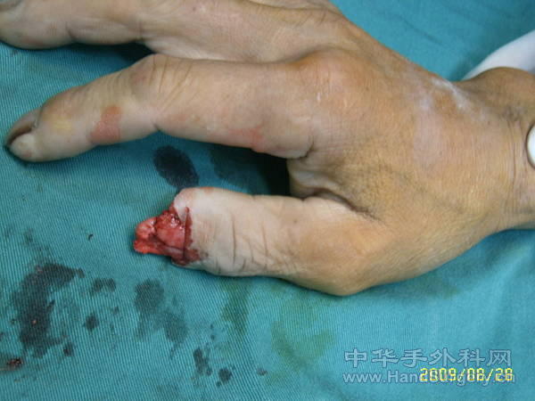 Suc55200.jpg