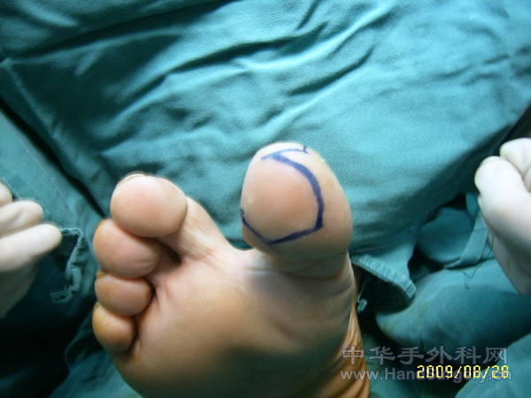 Suc55209.jpg