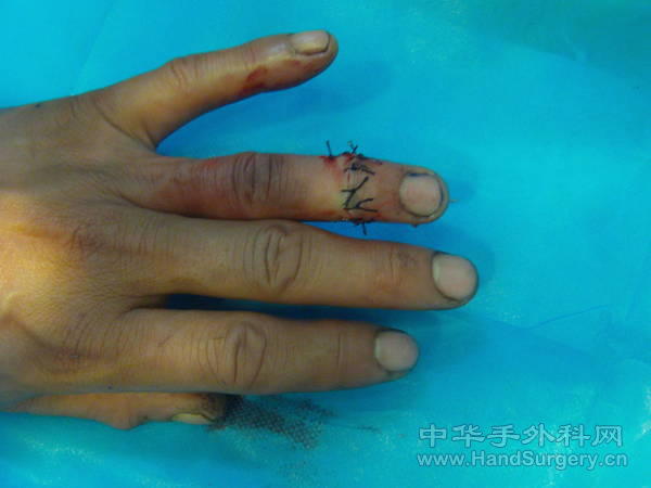 FILE0290.JPG