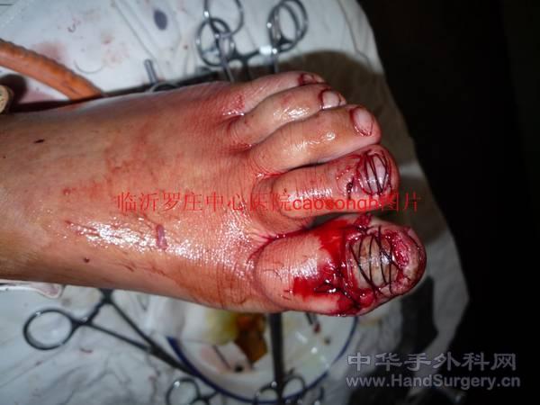 conew_p1090793[1].jpg
