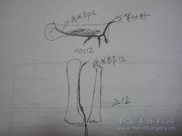 P1100415.JPG