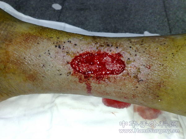 20101203185.jpg