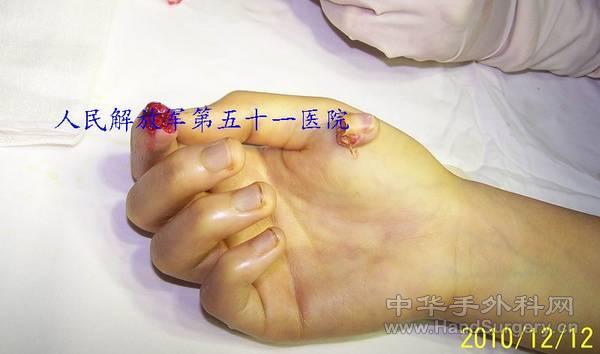 100_0528.jpg