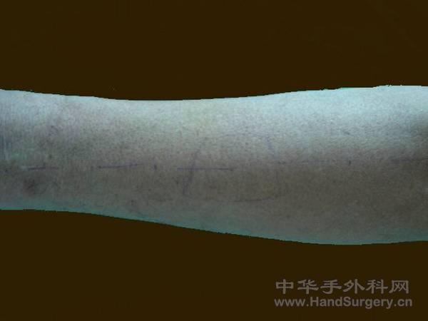 旋转 照片 102.jpg