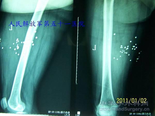100_0783.JPG