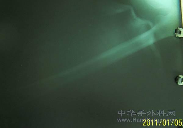 100_0825.jpg