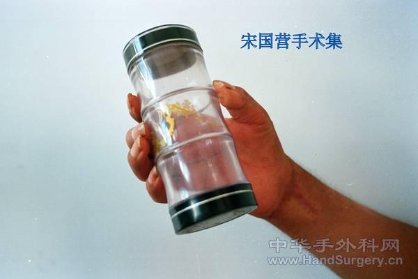 术后功能