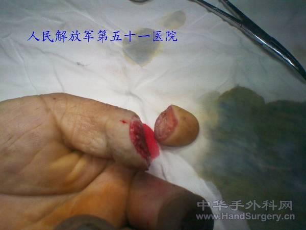 2011-01-12 01.15.05.jpg