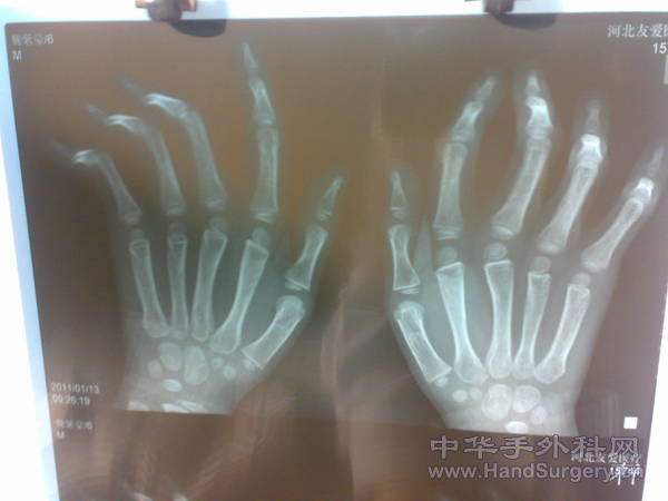20110113193.jpg