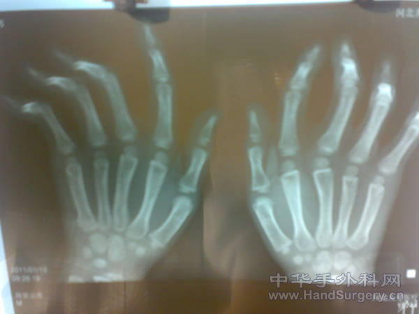 20110113197.jpg