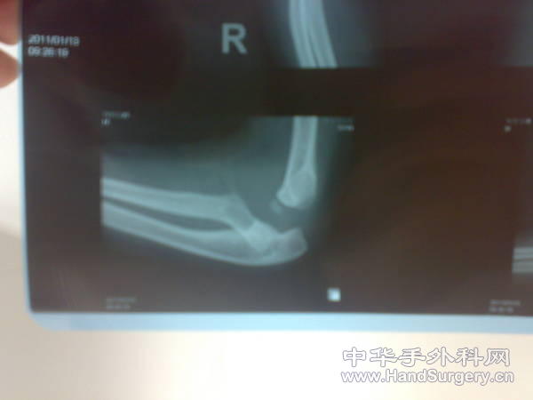 20110113199.jpg