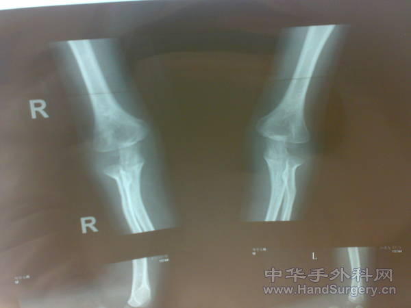 20110113198.jpg