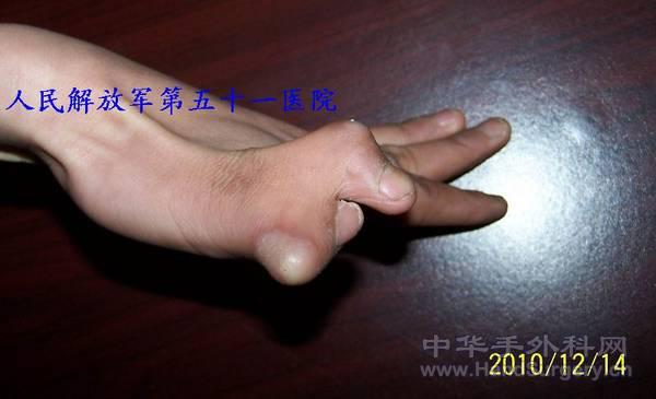 100_0577.jpg
