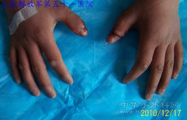 100_0588.jpg