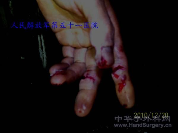 100_0643.JPG