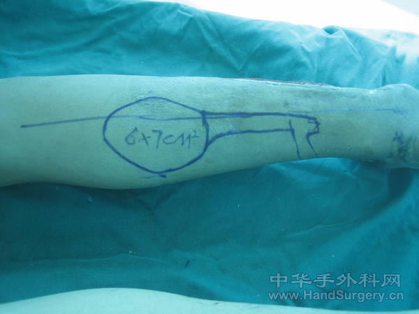 设计线