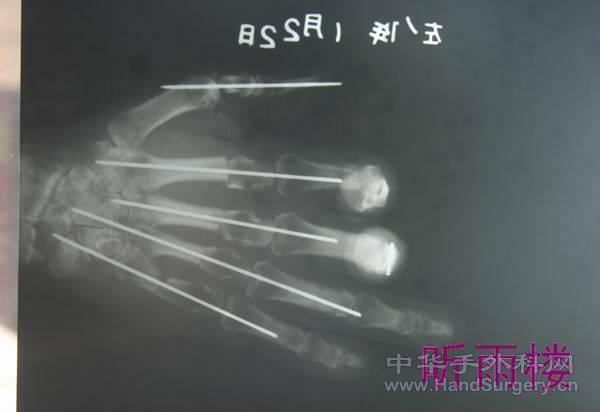 旋转 IMG_5882.JPG