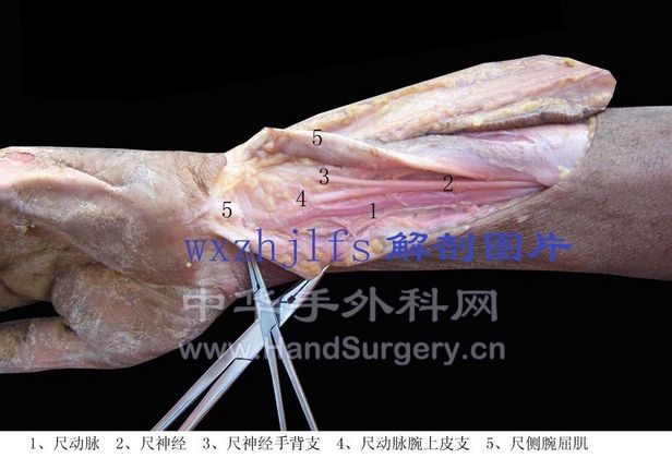 尺动脉腕上皮支掌面观