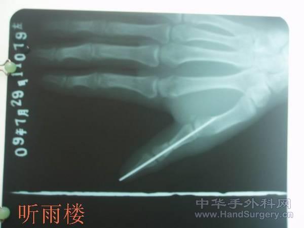 调整大小 P7290055.jpg