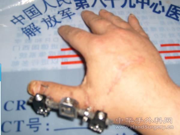 手1.jpg