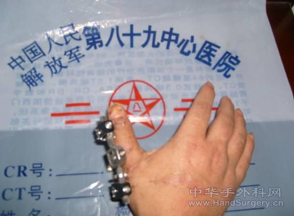 手2.jpg