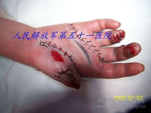 100_1484.JPG