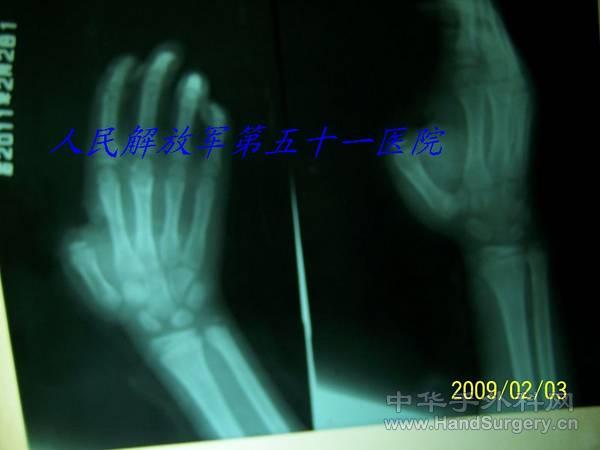100_1493.JPG