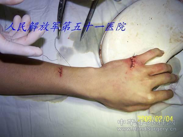 100_1514.JPG