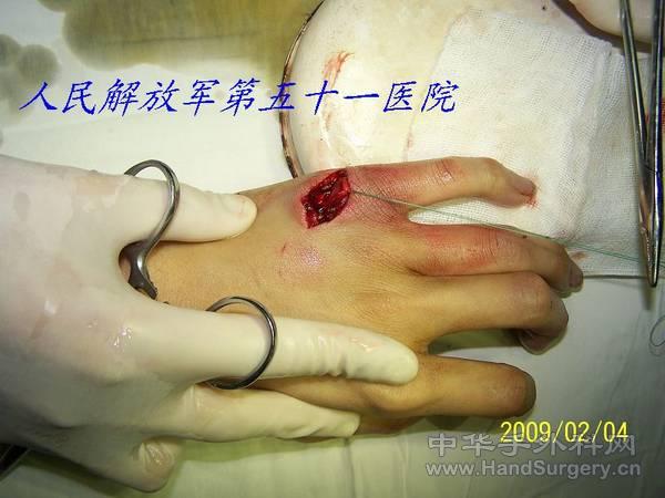 100_1511.JPG