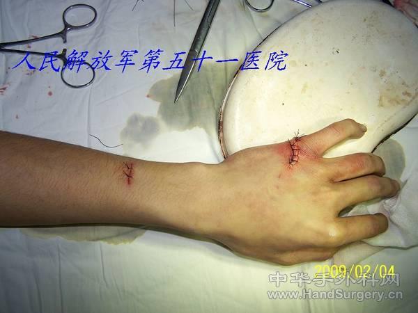 100_1513.JPG