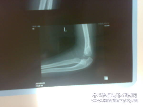 20110113200.jpg
