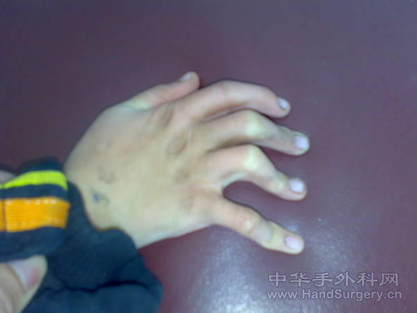 20110113204.jpg