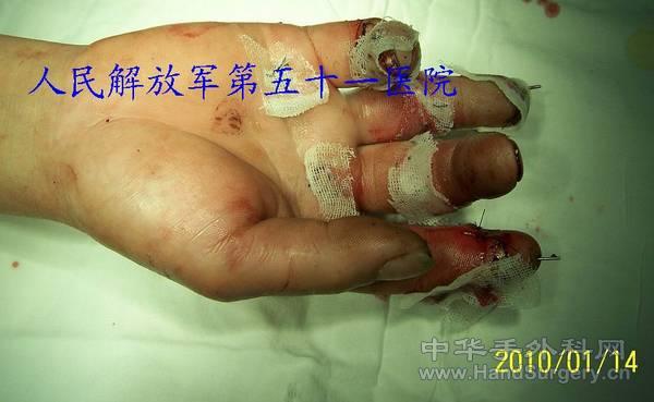 100_1196.jpg