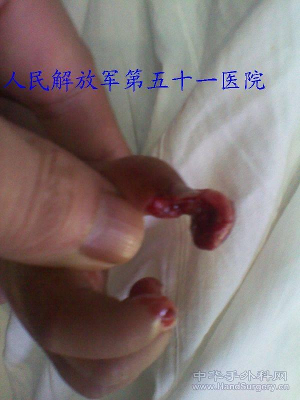 2011-01-15 15.56.39.jpg