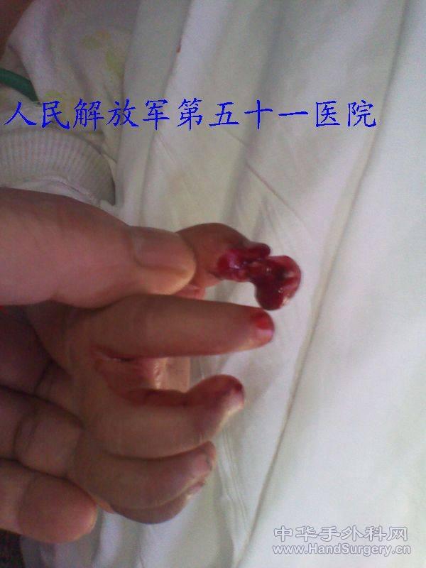 2011-01-15 15.57.38.jpg