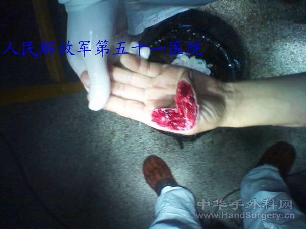 2011-01-15 17.35.43.jpg