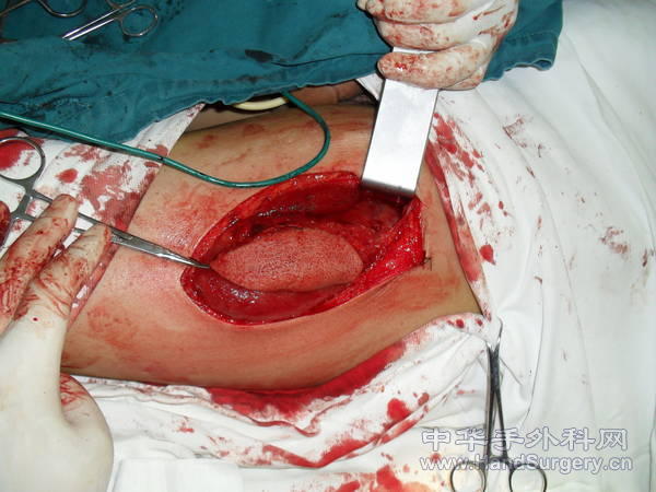 SDC11809.JPG
