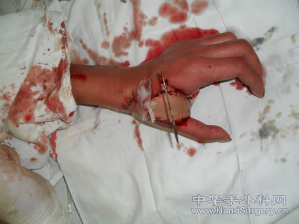 SDC11813.JPG