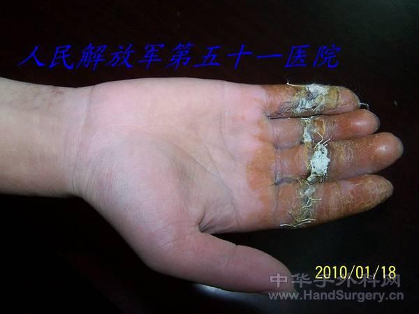 100_1239.JPG