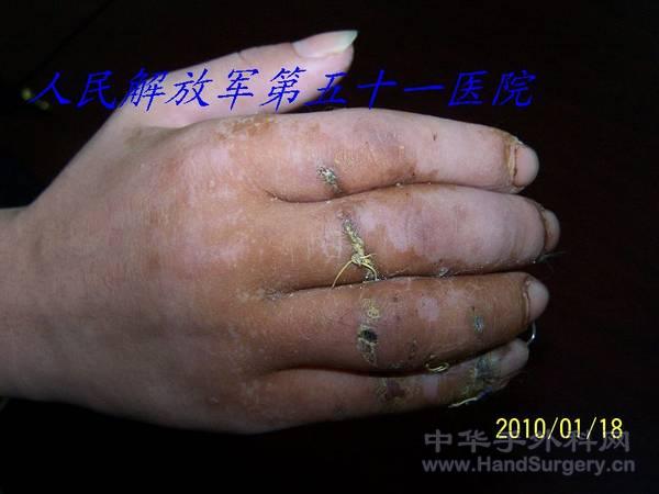 100_1244.JPG