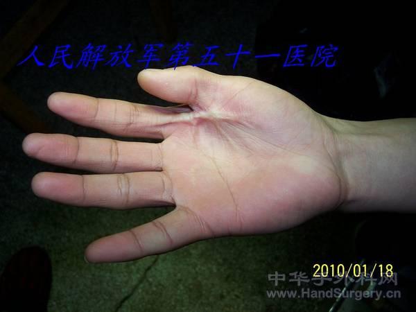 100_1202.JPG