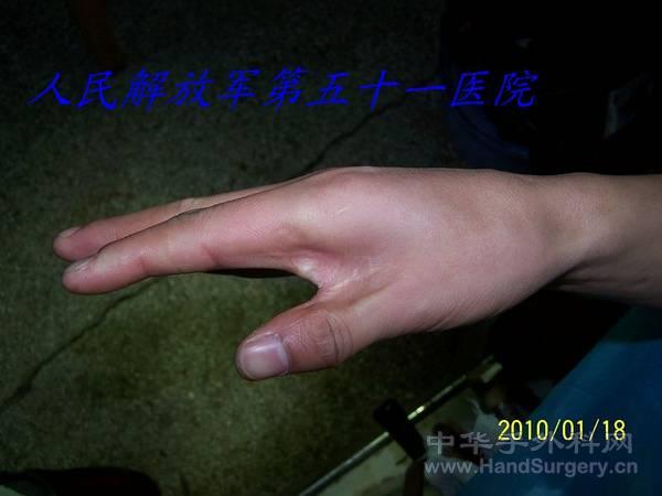 100_1206.JPG