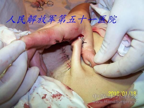 100_1209.JPG