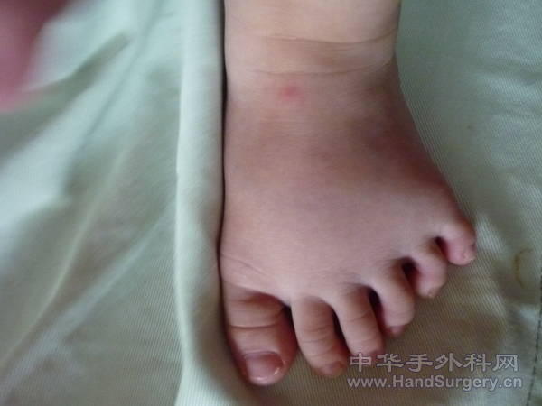 P1000401.JPG